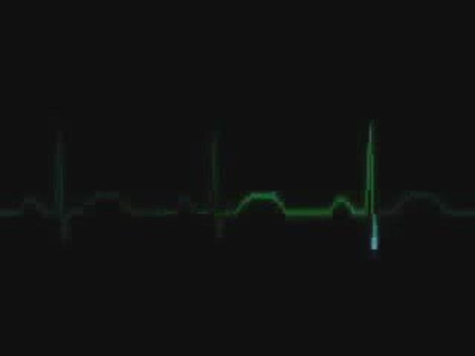 Rapimenti Alieni ( Corrado Malanga ) - PARTE 1