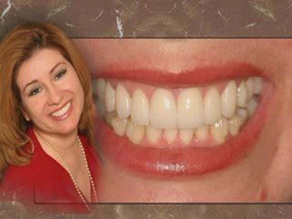 Cosmetic Dentist Olympia
