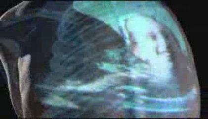 Don’t turn your back on osteoporosis