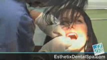 New York Periodontics - Esthetix Dental Spa Testimonial