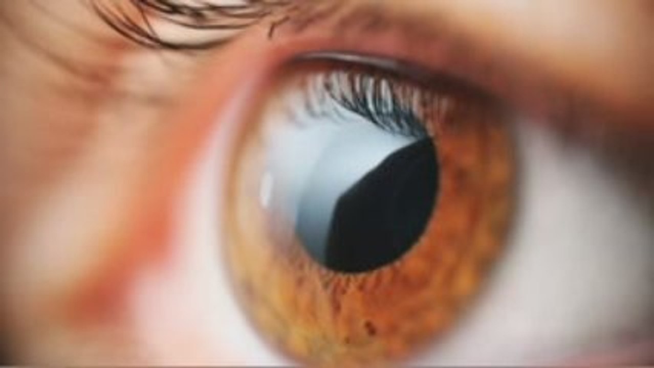 ICL Implantable Contact Lens Patients San Diego