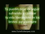 Quiere (Curar) el (Herpes)?- Ultimo Tratamiento