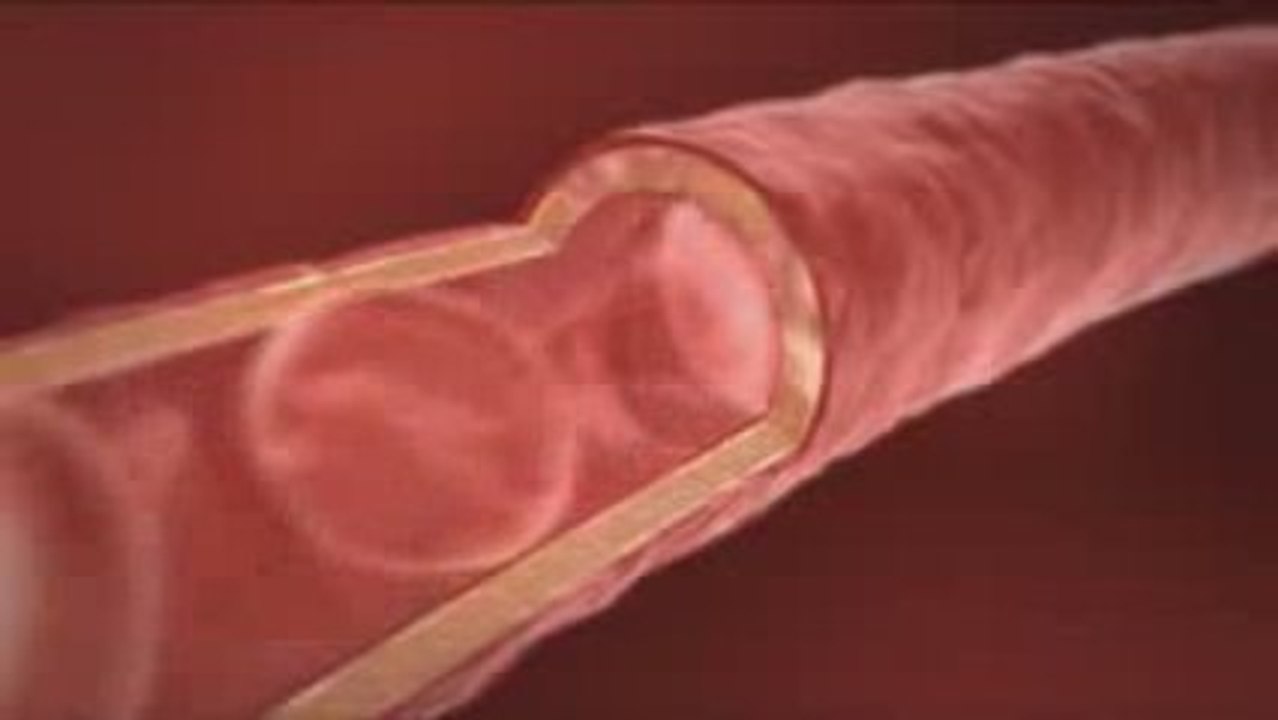 ALOE VERA SIVERA LR - Innovation Unique au Monde