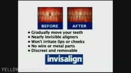 Root Canals Peabody Ma 978-535-8244