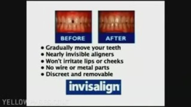 Implants Beverly Ma 978-535-8244