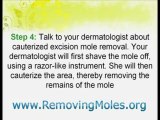 Skin Moles - Solutions And Remedies