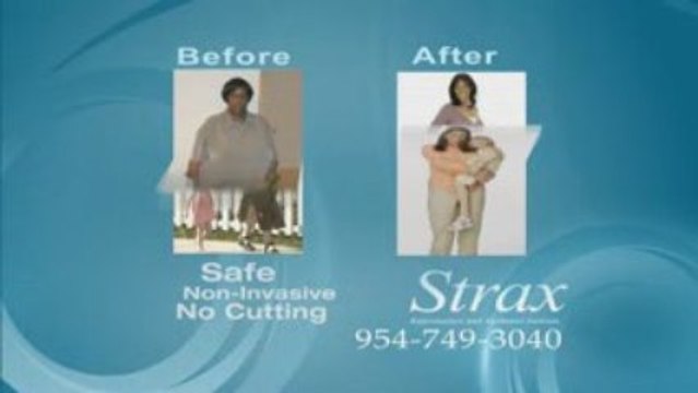Strax's Lap-Band Procedure: An In Office Procedure