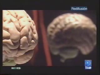 Cerebro dividido: Roger Sperry