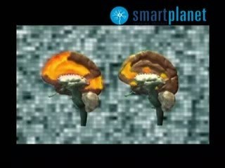 Cerebro del buscador de sensaciones: Toma de decisiones