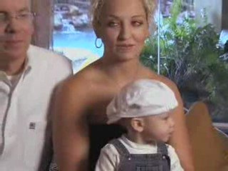 Houston Tummy Tuck Liposuction Abdominoplasty