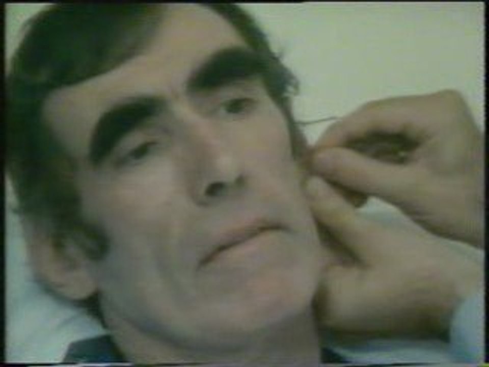 Acupuntura (2): Terapia alternativa