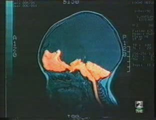 Plasticidad cerebral: Dr. Kogure