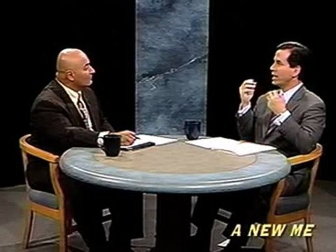 Cheek Lift Surgery Maryland Washington DC Dr. Mark Richards