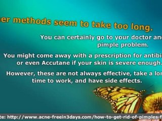 How to Get Rid of Pimples Fast - The Answer Isn't What You T