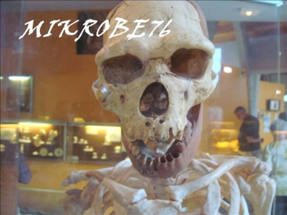 Mikrobe76