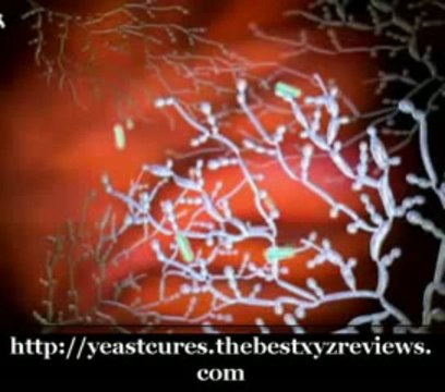 Candida yeast Yoghurt, A Natural Cure For Yeast Infection Po