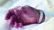 10 idées fausses concernant l'euthanasie