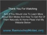 Skin Mole Removal With Apple Cider Vinegar