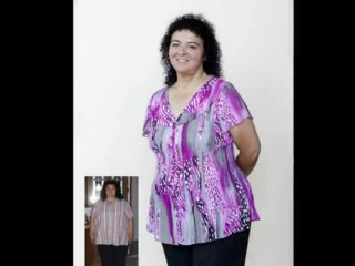 Know Your Options in Texas Bariatric Surgery