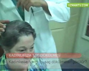 Kadınlarda hangi tip saç dökülmeleri görülür