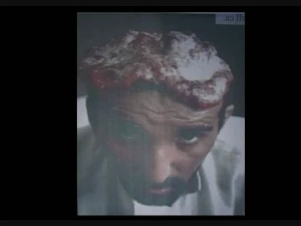 Armes A Uranium Appauvri part 3