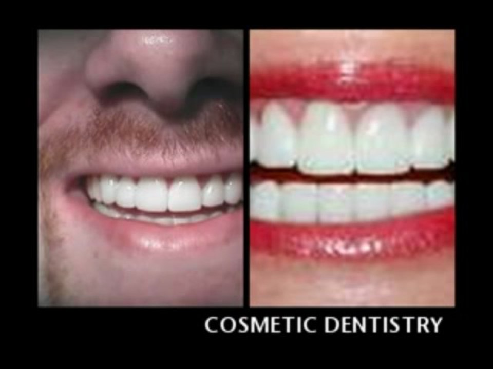 DR JJ EDDERAI EMERGENCY DENTIST NORTH MIAMI BEACH video