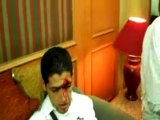 Joueurs algériens blessés par les supporters egyptiens