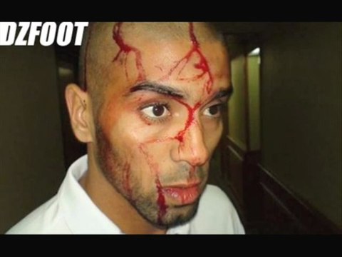 Agression de l'équipe Algérienne de Football en Egypte 5