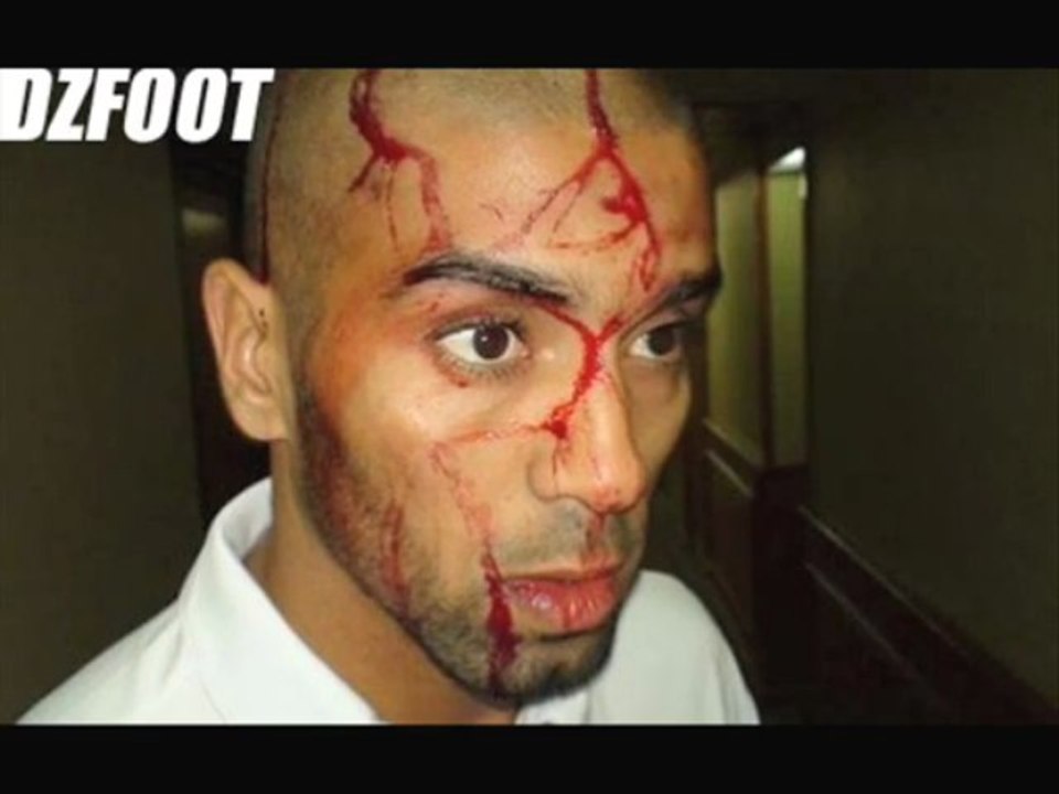 Agression de l'équipe Algérienne de Football en Egypte 5