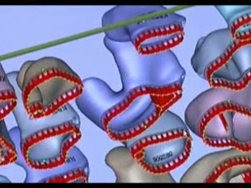 kind.com - Fertigung eines Im-Ohr-Hörgerätes