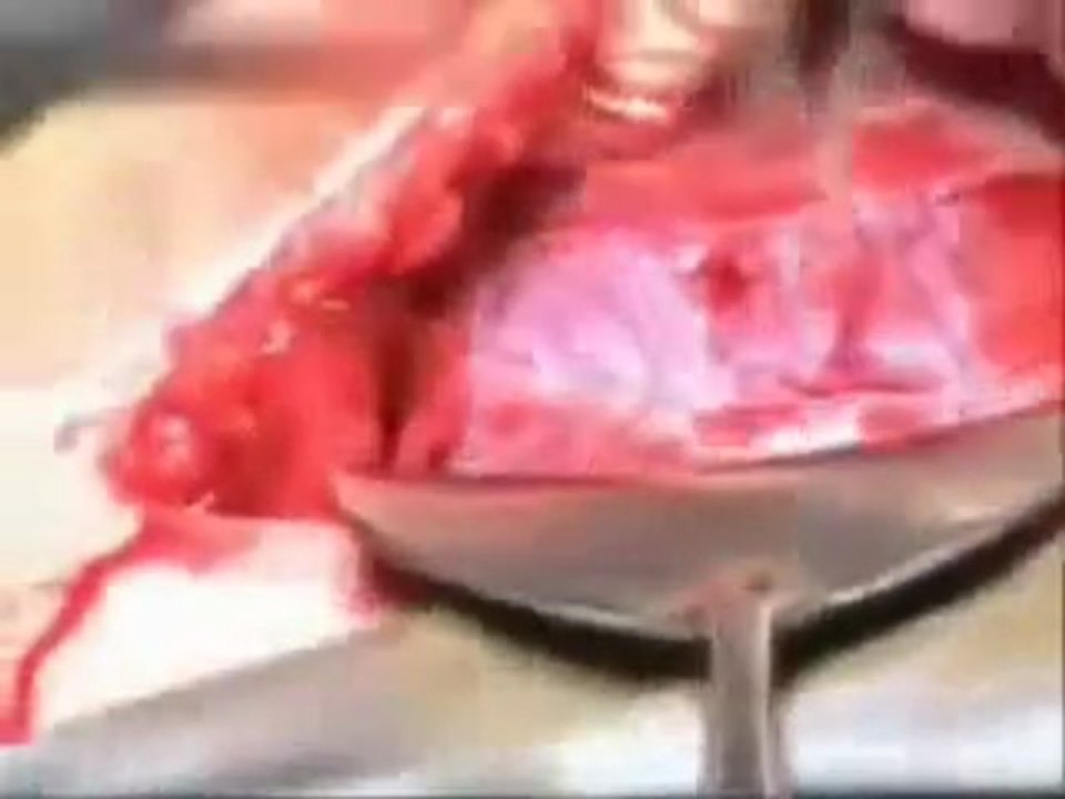 sezeryanla canlı doğum anı