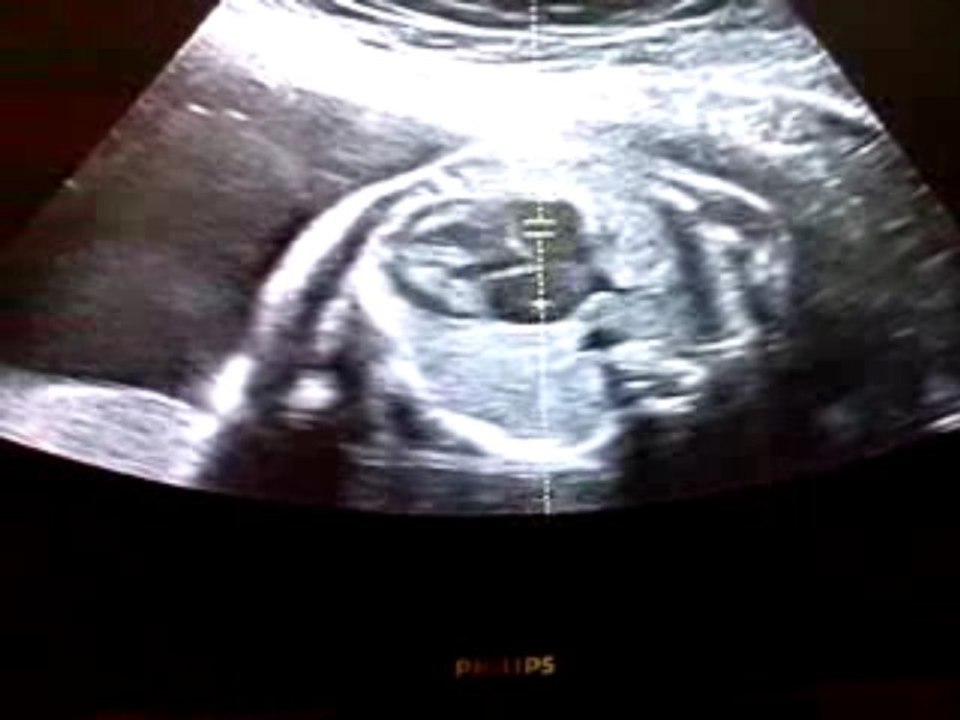 lea le 14/11/09 bientot 6 mois
