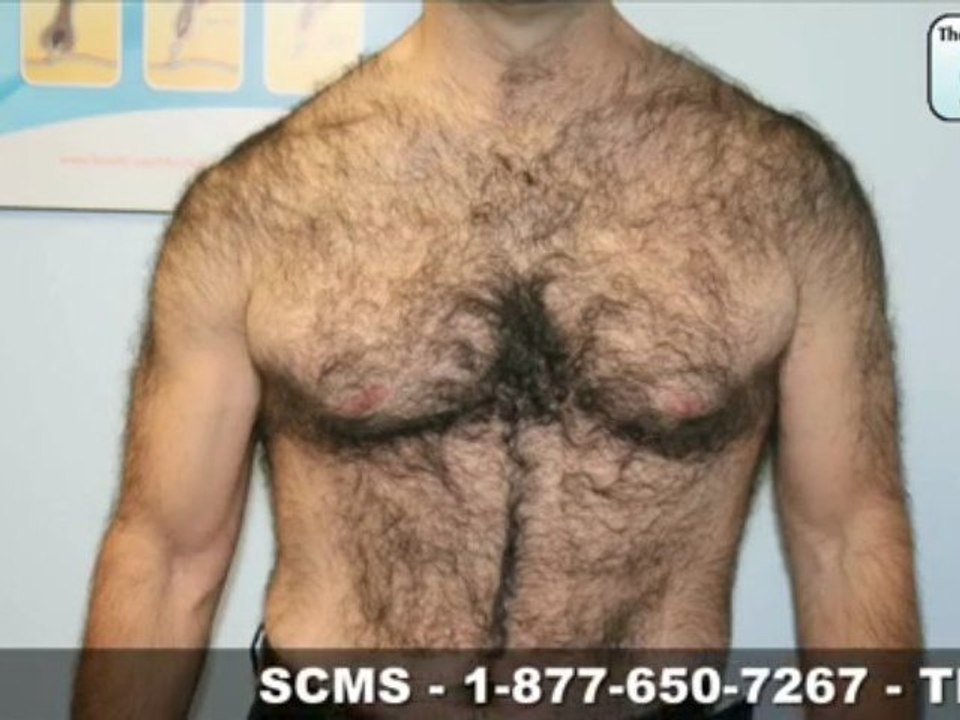 Dave Singer ESPN Laser Hair Removal Testimonial