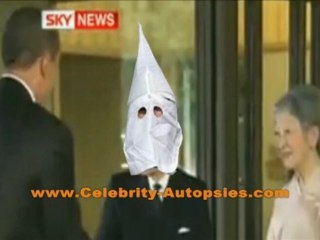 Biggest Loser Bows Down to the KKK Imperial Wizard