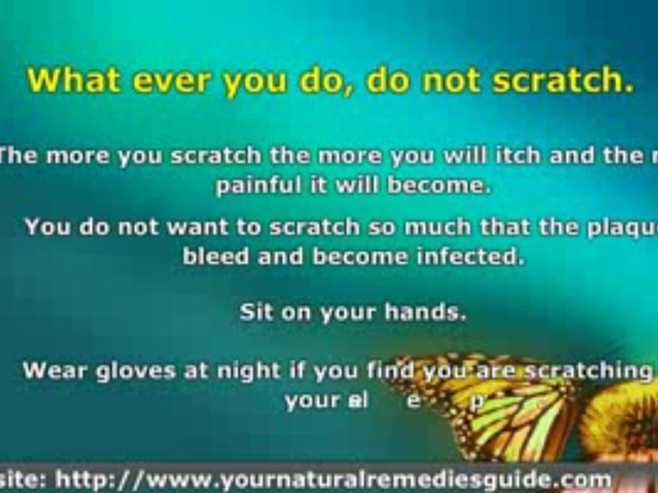 Psoriasis Treatment