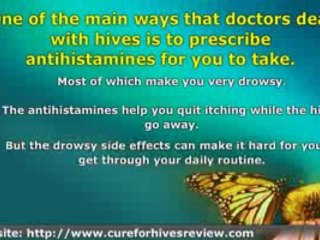 Cure For Hives