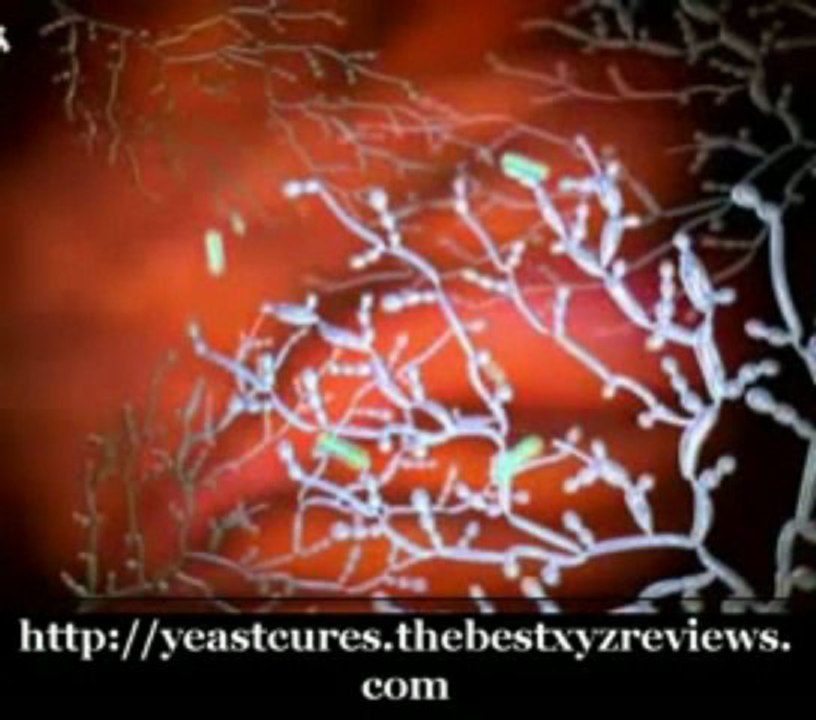 Male yeast infection The Manufacture Of Ethanol Posted By: W