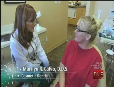 Porcelain Veneers Studio City-Marilyn Calvo Cosmetic Dentist