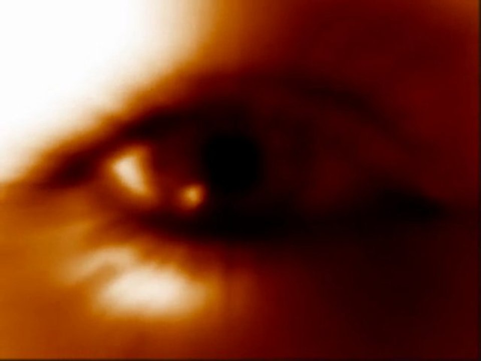 Eyes