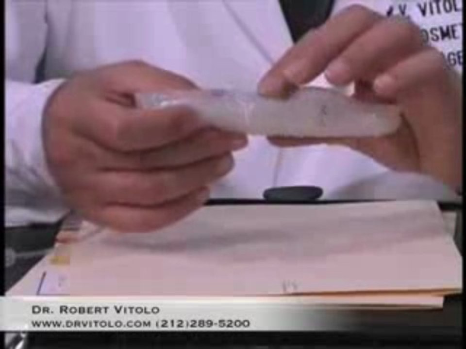 New york city breast implants Frequently Asked Questions Abo