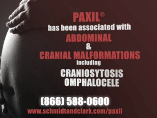 Eyecon Video Productions - Schmidt