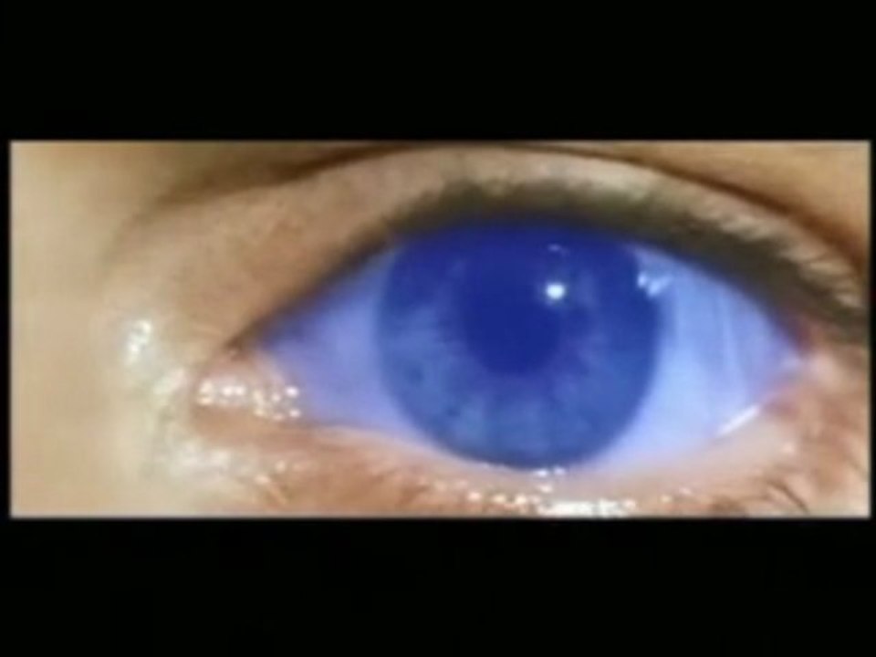 The Rasmus - Not Like The Other Girls