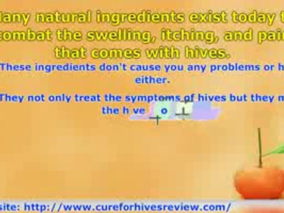 Hives Treatment