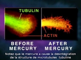 effets du mercure sur les neurones S/T