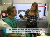 Dental Spa - Blanqueamiento Zoom - Dentalcare clínicas