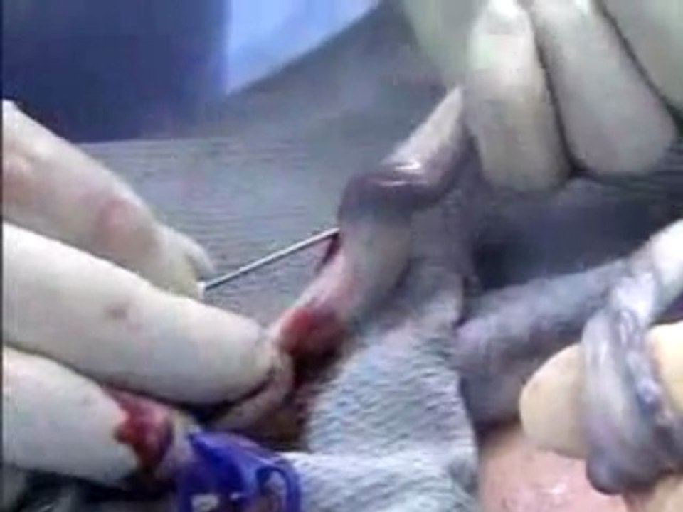 Cord Blood Collection @ www.cordbloodhelp.net