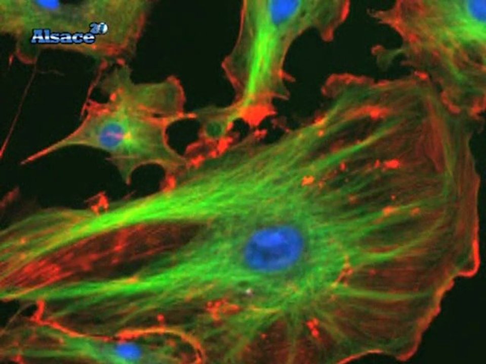 Téléthon : Guillaume, 15 ans, atteint de myopathie (Alsace)
