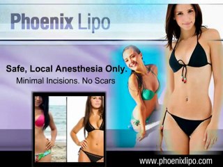 Phoenix Lipo: Top Liposuction Center in Phoenix