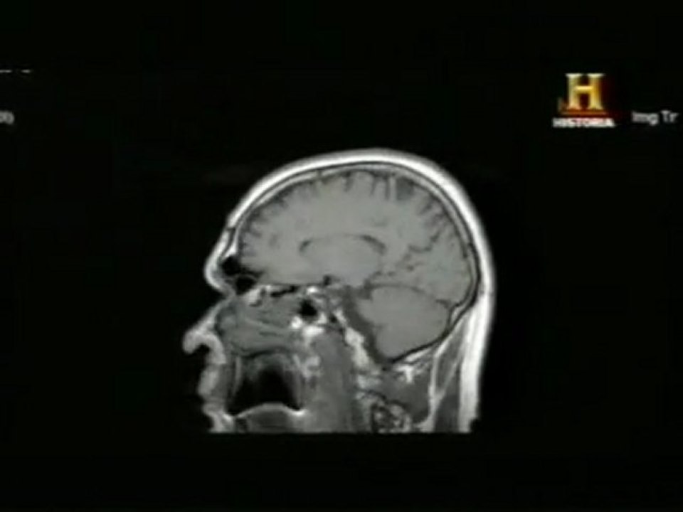 La avaricia: Bases neurobiologicas