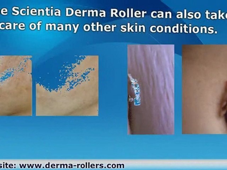 Plastic Scar Removal